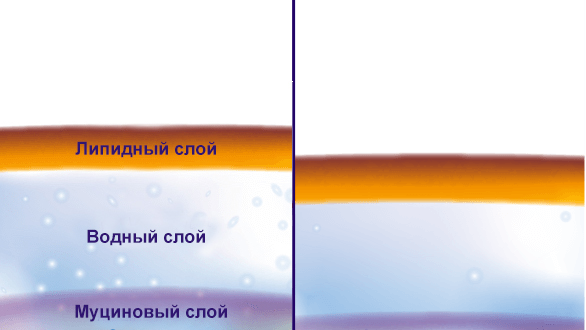 Trockene Augen Hypovolämisches Auge